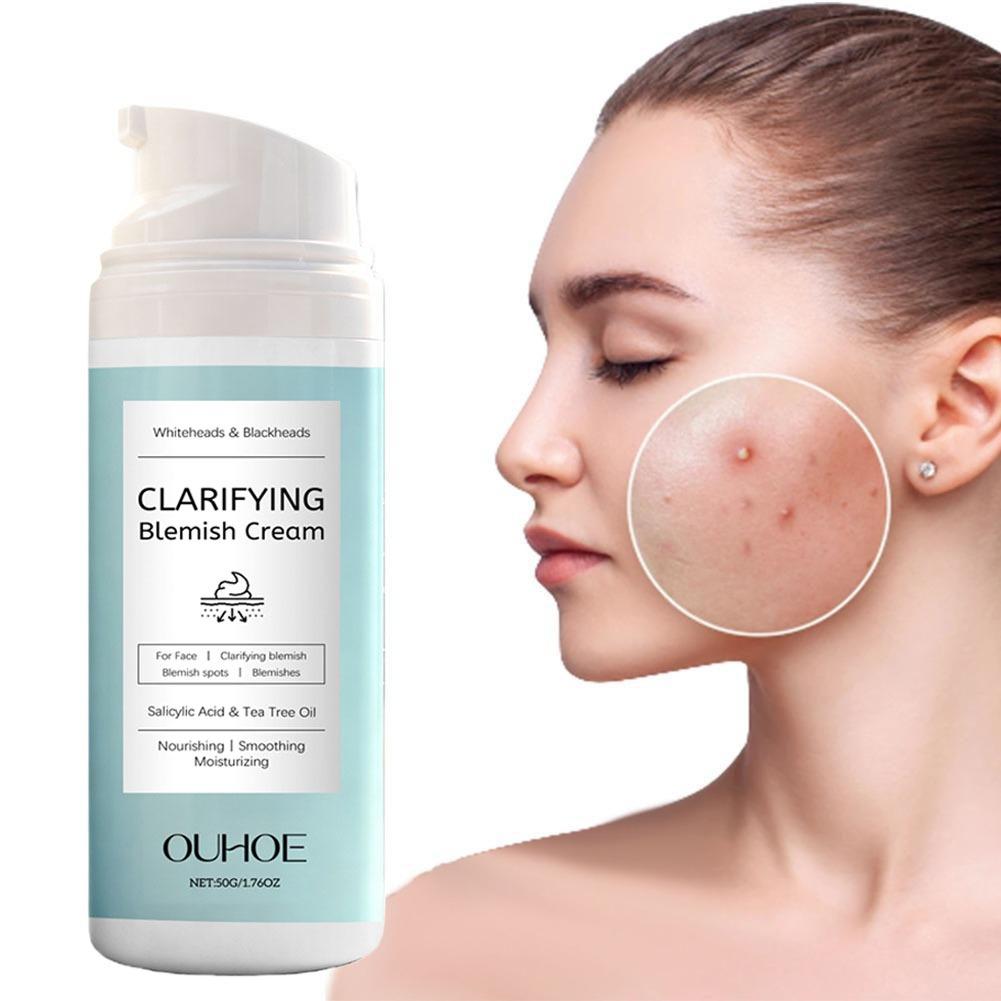 ครีมกำจัดสิวกรดซาลิไซลิก บำรุง - Salicylic Acid Blackhead Remover บทวิจารณ์และราคา
